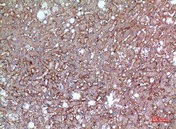 EMMPRIN rabbit pAb Antibody