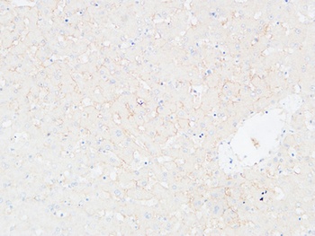 EMMPRIN rabbit pAb Antibody