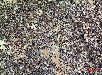 HRP-3 rabbit pAb Antibody