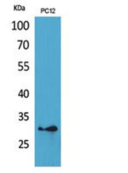 HLA-DQB1/2 rabbit pAb Antibody