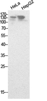 NCoA-3 rabbit pAb Antibody