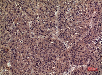 IL-1F8 rabbit pAb Antibody