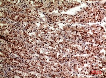 TERT rabbit pAb Antibody