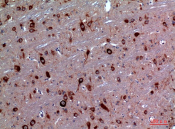 TRPC3 rabbit pAb Antibody