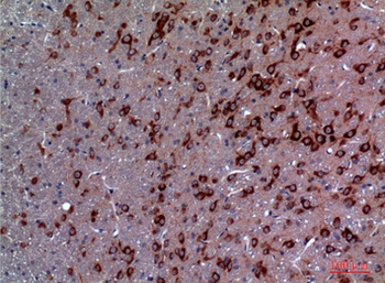 TRPC3 rabbit pAb Antibody