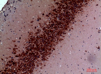 TRPC3 rabbit pAb Antibody