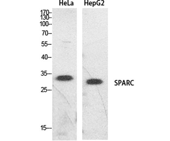 SPARC rabbit pAb Antibody