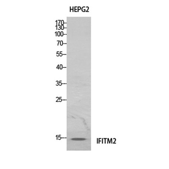 IFITM2 rabbit pAb Antibody