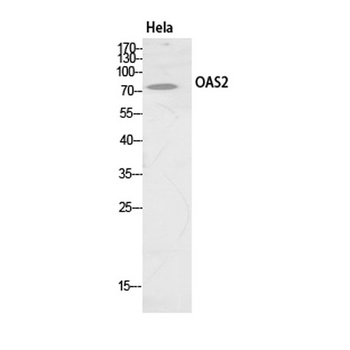 OAS2 rabbit pAb Antibody