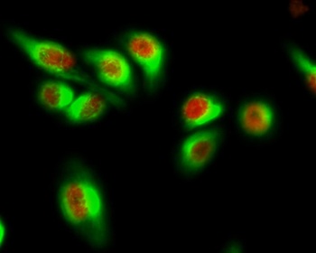 AR rabbit pAb Antibody