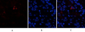 AR rabbit pAb Antibody