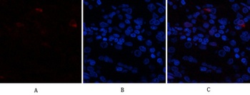AR rabbit pAb Antibody