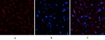 AR rabbit pAb Antibody
