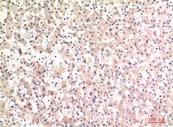 C4a/b rabbit pAb Antibody
