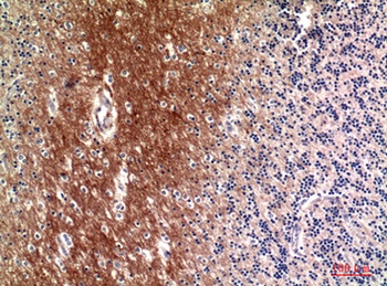 C4a/b rabbit pAb Antibody