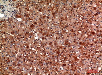 ANG I rabbit pAb Antibody