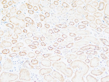 Tenascin-C rabbit pAb