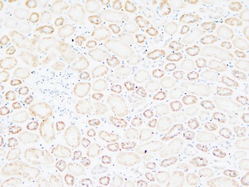Tenascin-C rabbit pAb