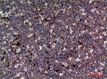 M-CSF rabbit pAb Antibody