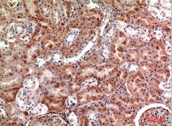 M-CSF rabbit pAb Antibody