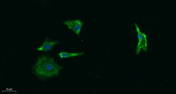 AChRα1 rabbit pAb Antibody