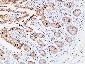 IL-3Rα rabbit pAb Antibody