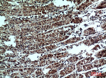 PPP1R15B rabbit pAb Antibody