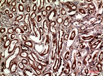 Talin-1 rabbit pAb Antibody
