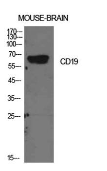 CD19 rabbit pAb Antibody
