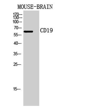 CD19 rabbit pAb Antibody