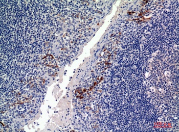 CD19 rabbit pAb Antibody