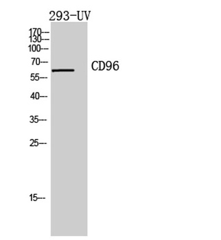 CD96 rabbit pAb Antibody