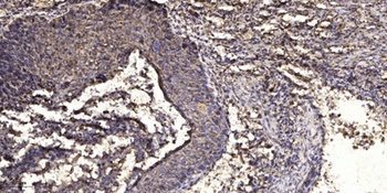 LIFR rabbit pAb Antibody