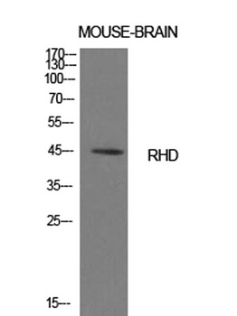 CD240d rabbit pAb Antibody