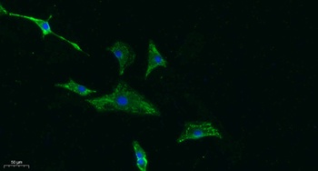 CD155 rabbit pAb Antibody