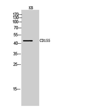 CD155 rabbit pAb Antibody