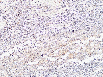 BMP-15 rabbit pAb Antibody