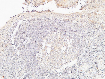 BMP-15 rabbit pAb Antibody