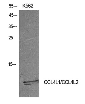 MIP-1b rabbit pAb Antibody