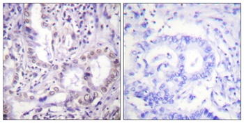Acetyl Lys proteins rabbit pAb