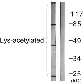 Acetyl Lys proteins rabbit pAb