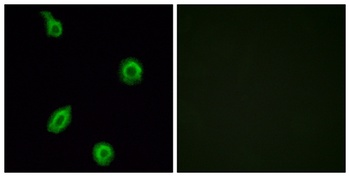 SR-5B rabbit pAb Antibody