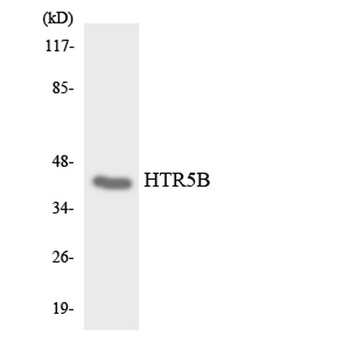 SR-5B rabbit pAb Antibody