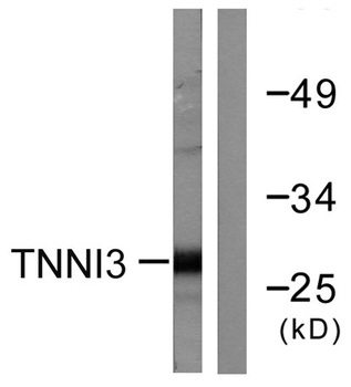 Troponin I-C rabbit pAb Antibody