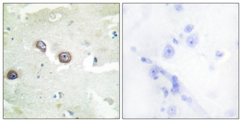 R-cadherin rabbit pAb Antibody