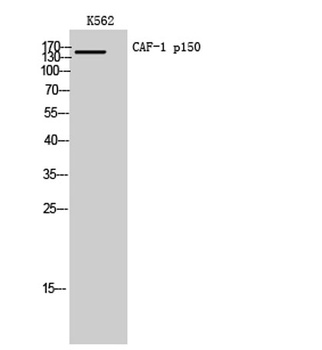 CAF-1 p150 rabbit pAb Antibody