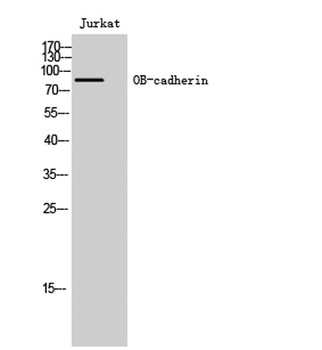 OB-cadherin rabbit pAb Antibody