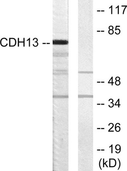 T-cadherin rabbit pAb Antibody