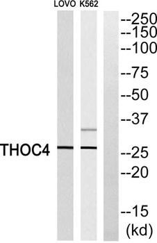 ALY rabbit pAb Antibody