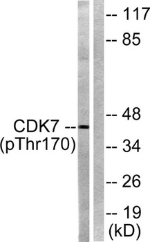 Cdk7 (phospho Thr170) rabbit pAb Antibody